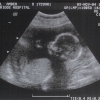 Ultrasound Week 18 Picture