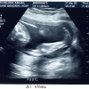 Ultrasound Week 21 Picture