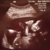 Ultrasound Week 21 Picture
