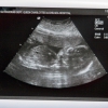 Ultrasound Week 22 Picture