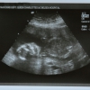 Ultrasound Week 22 Picture