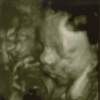 Ultrasound Week 30 Picture