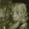Ultrasound Week 30 Picture