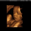 Ultrasound Week 32 Picture